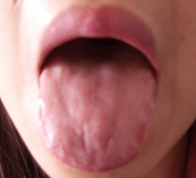 IMGP4870.JPG